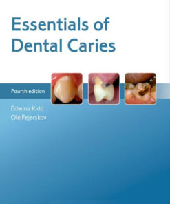 Essentials of Dental Caries 4th Edition