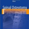 Spinal Osteotomy 2015th Edition