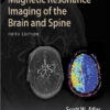 Magnetic Resonance Imaging of the Brain and Spine Fifth Edition PDF