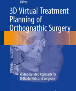 3D Virtual Treatment Planning of Orthognathic Surgery: A Step-by-Step Approach for Orthodontists and Surgeons 1st ed. 2017 Edition PDF