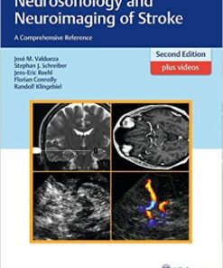 Neurosonology and Neuroimaging of Stroke : A Comprehensive Reference 2nd edition – Original PDF + (129 VIDEOS+ 8 Additional Files)​