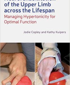 Neurorehabilitation of the Upper Limb Across the Lifespan: Managing Hypertonicity for Optimal Function 1st Edition