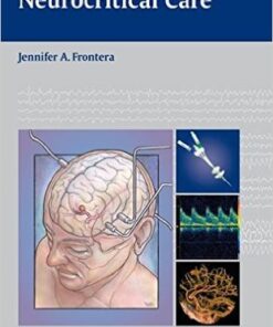 Decision Making in Neurocritical Care 1st Edition