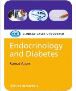Endocrinology and Diabetes: Clinical Cases Uncovered PDF