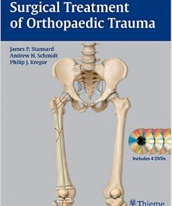 Surgical Treatment of Orthopaedic Trauma