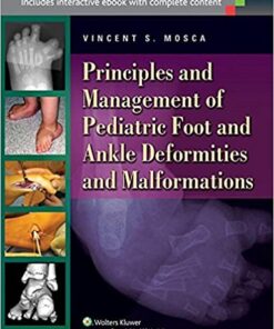 Principles and Management of Pediatric Foot and Ankle Deformities and Malformations PDF