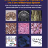 WHO Classification of Tumours of the Central Nervous System (IARC WHO Classification of Tumours) 4  Edition PDF ORIGINAL