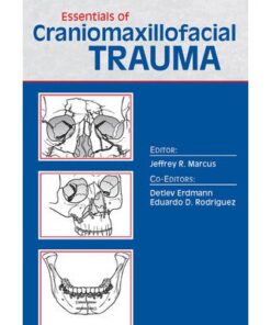 Essentials of Craniomaxillofacial Trauma PDF