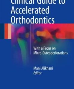 Clinical Guide to Accelerated Orthodontics : With a Focus on Micro-Osteoperforations PDF