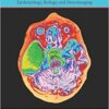 Arachnoid Cysts: Epidemiology, Biology, and Neuroimaging 1st Edition PDF