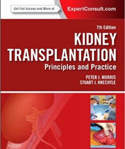 Kidney Transplantation - Principles and Practice 7th Edition PDF