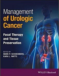 Management of Urologic Cancer Focal Therapy and Tissue Preservation PDF
