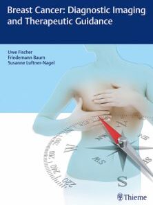 Breast Cancer Diagnostic Imaging and Therapeutic Guidance PDF