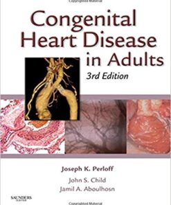 Congenital Heart Disease in Adults (Congenital Heart Disease in Adults (Perloff/Child)) 3rd Edition Epub
