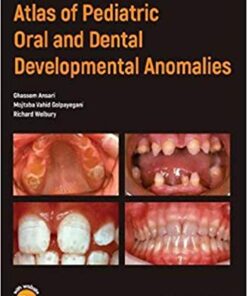 Atlas of Pediatric Oral and Dental Developmental Anomalies 1st Edition PDF