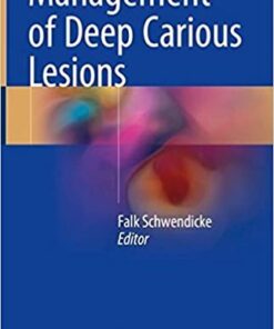 Management of Deep Carious Lesions 1st ed. 2018 Edition PDF