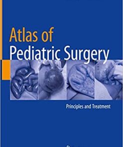 Atlas of Pediatric Surgery: Principles and Treatment 1st ed. 2020 Edition PDF