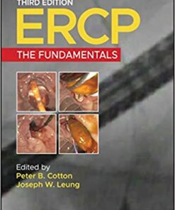 ERCP: The Fundamentals 3rd Edition PDF