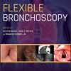 Flexible Bronchoscopy 4th Edition PDF