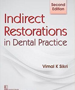 Indirect Restorations in Dental Practice 2/e Edition PDF