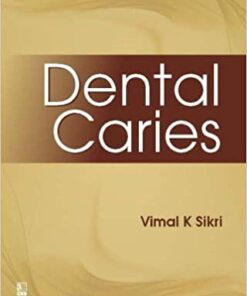 DENTAL CARIES 1st Edition PDF