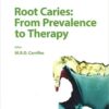 Root Caries: From Prevalence to Therapy 1st Edition PDF