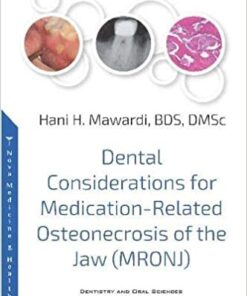 Dental Considerations for Medication-Related Osteonecrosis of the Jaw (MRONJ) 1st Edition PDF