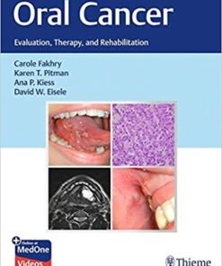 Oral Cancer: Evaluation, Therapy, and Rehabilitation 1st Edition PDF