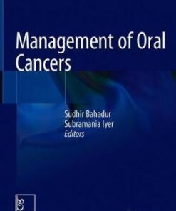 Management of Oral Cancers PDF