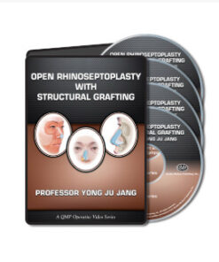 Ultrasonic Rhinoplasty Using a Full Open Approach: A Revolution in Rhinoplasty