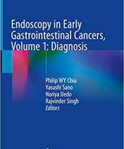 Endoscopy in Early Gastrointestinal Cancers, Volume 1: Diagnosis 1st ed. 2021 Edition PDF