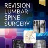 Revision Lumbar Spine Surgery E-Book 1st Edition PDF