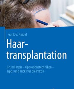 Haartransplantation: Grundlagen – Operationstechniken – Tipps und Tricks für die Praxis (German Edition) 1. Aufl. 2022 Edition PDF Original