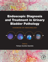 Endoscopic Diagnosis and Treatment in Urinary Bladder Pathology Handbook of Endourology