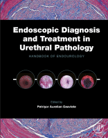 Endoscopic Diagnosis and Treatment in Urethral Pathology Handbook of Endourology