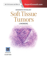 Diagnostic Pathology: Soft Tissue Tumors