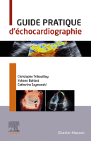 Guide Pratique D'échocardiographie