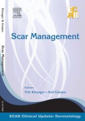 Scar Management - ECAB