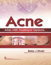 Acne Atlas with Treatment Options 2018 Original PDF
