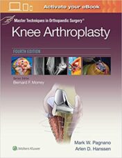 Master Techniques in Orthopedic Surgery: Knee Arthroplasty (Master Techniques in Orthopaedic Surgery) Fourth Ed