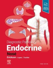 Diagnostic Pathology: Endocrine, 3rd edition (Original PDF
