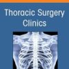 Lung Transplantation, An Issue of Thoracic Surgery Clinics (Volume 32-2) (The Clinics: Internal Medicine, Volume 32-2) 2022 Original PDF