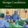 Hysterectomy for Benign Conditions 2022 Original PDF
