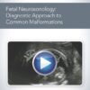 aium fetal neurosonology diagnostic approach to common malformations medical video courses 977255 720x 1