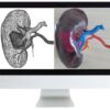 arrs 3d printing of anatomic models value added opportunity for radiology 2019 medical video courses 749027 540x