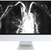 arrs advanced chest imaging 2019 medical video courses 217836 540x 1