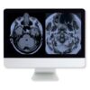 arrs artifacts physics in daily imaging a case based approach medical video courses 527604 540x