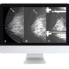 arrs breast imaging screening and diagnosis medical video courses 615918 540x