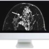 arrs clinical case based review of breast imaging 2019 medical video courses 867990 540x