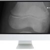 arrs clinical case based review of musculoskeletal imaging 2019 medical video courses 495313 540x